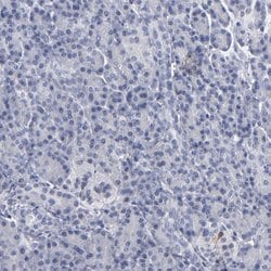 Invitrogen RPH3A Polyclonal Antibody 100 &mu;L; Unconjugated:Antibodies,