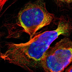 Invitrogen DDX24 Polyclonal Antibody 100 &mu;L; Unconjugated:Antibodies,