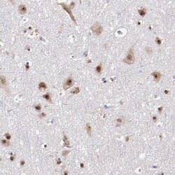 Invitrogen DDX24 Polyclonal Antibody 100 &mu;L; Unconjugated:Antibodies,