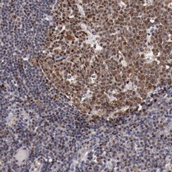 Invitrogen DDX24 Polyclonal Antibody 100 &mu;L; Unconjugated:Antibodies,