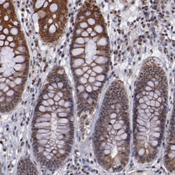 Invitrogen DDX24 Polyclonal Antibody 100 &mu;L; Unconjugated:Antibodies,