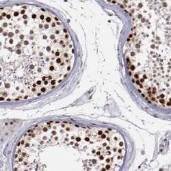 Invitrogen DDX24 Polyclonal Antibody 100 &mu;L; Unconjugated:Antibodies,