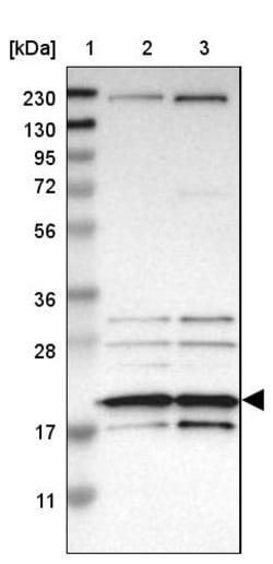 Invitrogen eIF1AX Polyclonal Antibody 100 &mu;L | Buy Online | Invitrogen&trade; | Fisher Scientific