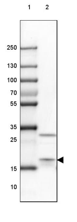 Invitrogen eIF1AX Polyclonal Antibody 100 &mu;L | Buy Online | Invitrogen&trade; | Fisher Scientific