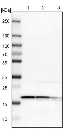 Invitrogen eIF1AX Polyclonal Antibody 100 &mu;L | Buy Online | Invitrogen&trade; | Fisher Scientific