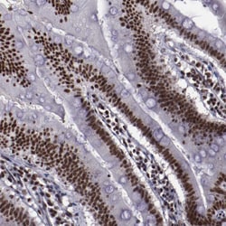 Invitrogen ERH Polyclonal Antibody 100 μL; Unconjugated:Antibodies,