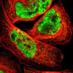 Invitrogen SMEK1 Polyclonal Antibody 100 &mu;L; Unconjugated:Antibodies,