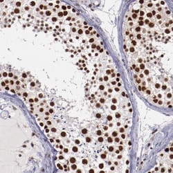 Invitrogen SMEK1 Polyclonal Antibody 100 &mu;L; Unconjugated:Antibodies,