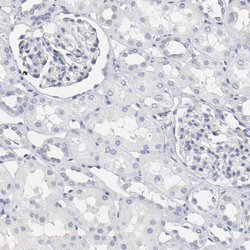 Invitrogen NCAPH Polyclonal Antibody 100 &mu;L; Unconjugated:Antibodies,