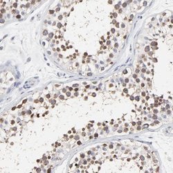 Invitrogen NCAPH Polyclonal Antibody 100 &mu;L; Unconjugated:Antibodies,
