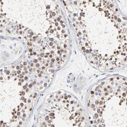 Invitrogen NCAPH Polyclonal Antibody 100 &mu;L; Unconjugated:Antibodies,