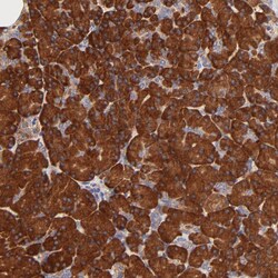 Invitrogen RPL27 Polyclonal Antibody 100 &mu;L | Buy Online | Invitrogen&trade; | Fisher Scientific