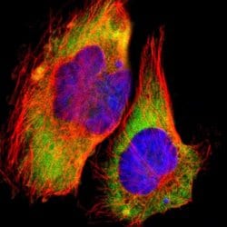 Invitrogen RPL30 Polyclonal Antibody 100 &mu;L; Unconjugated:Antibodies,