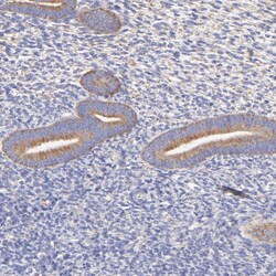 Invitrogen RPL30 Polyclonal Antibody 100 &mu;L; Unconjugated:Antibodies,