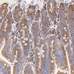 Invitrogen RPL30 Polyclonal Antibody 100 &mu;L; Unconjugated:Antibodies,