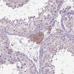 Invitrogen Carboxypeptidase M Polyclonal Antibody 100 &mu;L; Unconjugated:Antibodies,