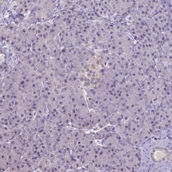 Invitrogen Carboxypeptidase M Polyclonal Antibody 100 &mu;L; Unconjugated:Antibodies,