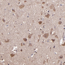 Invitrogen WASH1 Polyclonal Antibody 100 &mu;L; Unconjugated:Antibodies,