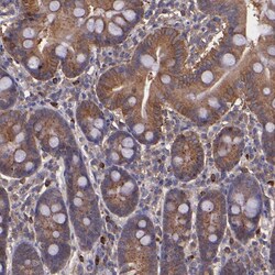 Invitrogen WASH1 Polyclonal Antibody 100 &mu;L; Unconjugated:Antibodies,