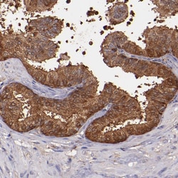 Invitrogen WASH1 Polyclonal Antibody 100 &mu;L; Unconjugated:Antibodies,