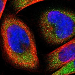 Invitrogen FTSJ1 Polyclonal Antibody 100 &mu;L; Unconjugated:Antibodies,