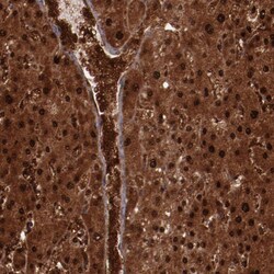 Invitrogen FTSJ1 Polyclonal Antibody 100 &mu;L; Unconjugated:Antibodies,