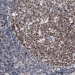 Invitrogen BAZ1A Polyclonal Antibody 100 &mu;L; Unconjugated:Antibodies,