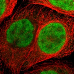 Invitrogen ZNF544 Polyclonal Antibody 100 &mu;L | Buy Online | Invitrogen&trade; | Fisher Scientific