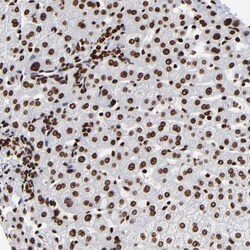 Invitrogen ZNF544 Polyclonal Antibody 100 &mu;L | Buy Online | Invitrogen&trade; | Fisher Scientific