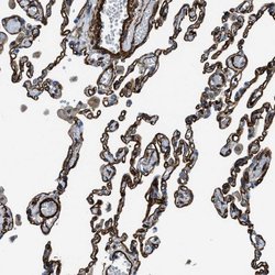 Invitrogen NAB1 Polyclonal Antibody 100 &mu;L | Buy Online | Invitrogen&trade; | Fisher Scientific