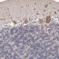 Invitrogen CXorf36 Polyclonal Antibody 100 &mu;L; Unconjugated:Antibodies,