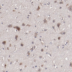 Invitrogen CXorf36 Polyclonal Antibody 100 &mu;L; Unconjugated:Antibodies,