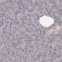 Invitrogen CXorf36 Polyclonal Antibody 100 &mu;L; Unconjugated:Antibodies,