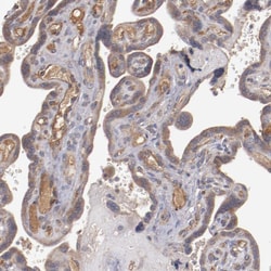 Invitrogen CXorf36 Polyclonal Antibody 100 &mu;L; Unconjugated:Antibodies,