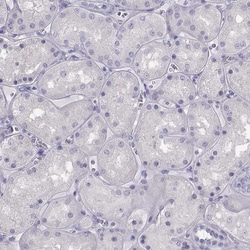 Invitrogen MAGEB1 Polyclonal Antibody 100 &mu;L; Unconjugated:Antibodies,