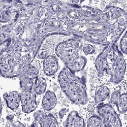 Invitrogen MAGEB1 Polyclonal Antibody 100 &mu;L; Unconjugated:Antibodies,