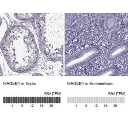 Invitrogen MAGEB1 Polyclonal Antibody 100 &mu;L; Unconjugated:Antibodies,