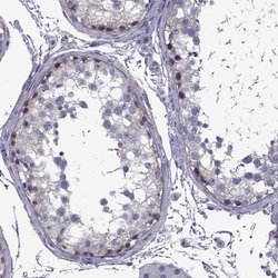 Invitrogen MAGEB1 Polyclonal Antibody 100 &mu;L; Unconjugated:Antibodies,