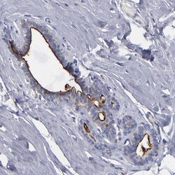 Invitrogen TM4SF1 Polyclonal Antibody 100 &mu;L; Unconjugated:Antibodies,