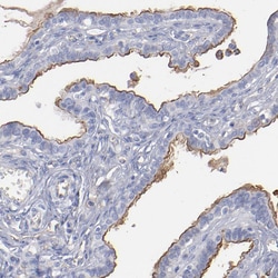 Invitrogen TM4SF1 Polyclonal Antibody 100 &mu;L; Unconjugated:Antibodies,