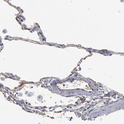 Invitrogen TM4SF1 Polyclonal Antibody 100 &mu;L; Unconjugated:Antibodies,