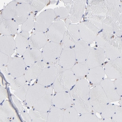 Invitrogen TM4SF1 Polyclonal Antibody 100 &mu;L; Unconjugated:Antibodies,