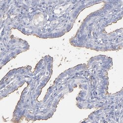 Invitrogen TM4SF1 Polyclonal Antibody 100 &mu;L; Unconjugated:Antibodies,