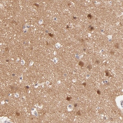 Invitrogen TXNL1 Polyclonal Antibody 100 &mu;L; Unconjugated:Antibodies,