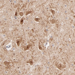 Invitrogen TXNL1 Polyclonal Antibody 100 &mu;L; Unconjugated:Antibodies,