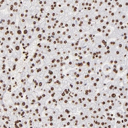 Invitrogen FBXO18 Polyclonal Antibody 100 &mu;L; Unconjugated:Antibodies,