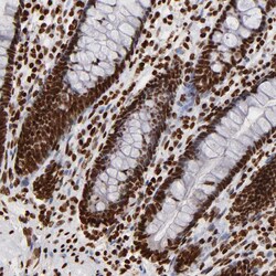 Invitrogen FBXO18 Polyclonal Antibody 100 &mu;L; Unconjugated:Antibodies,
