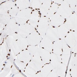 Invitrogen FBXO18 Polyclonal Antibody 100 &mu;L; Unconjugated:Antibodies,