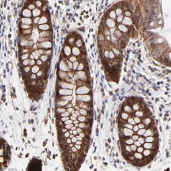 Invitrogen FRMD8 Polyclonal Antibody 100 &mu;L | Buy Online | Invitrogen&trade; | Fisher Scientific