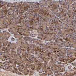 Invitrogen FRMD8 Polyclonal Antibody 100 &mu;L | Buy Online | Invitrogen&trade; | Fisher Scientific